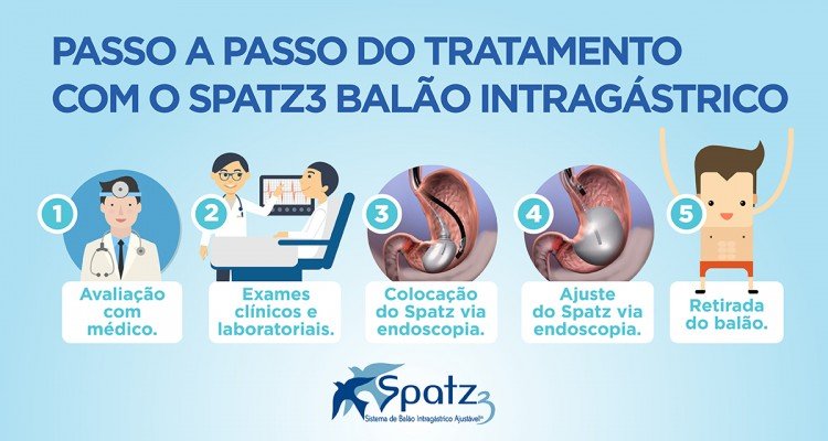 SAIBA TUDO SOBRE O TRATAMENTO COM O BALÃO INTRAGÁSTRICO DE UM ANO